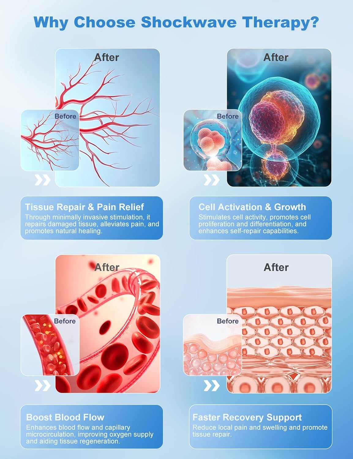 Extracorporeal Shockwave Therapy Machine for Muscle & Joint Relief